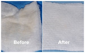 Halitosis patient photos of gauze before and after treatment.