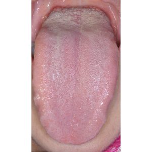 Tongue Before